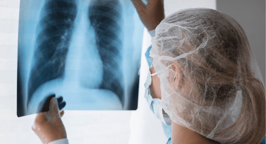 KUĆNI DUHOVI: RADON I NJEGOVI POTOMCI